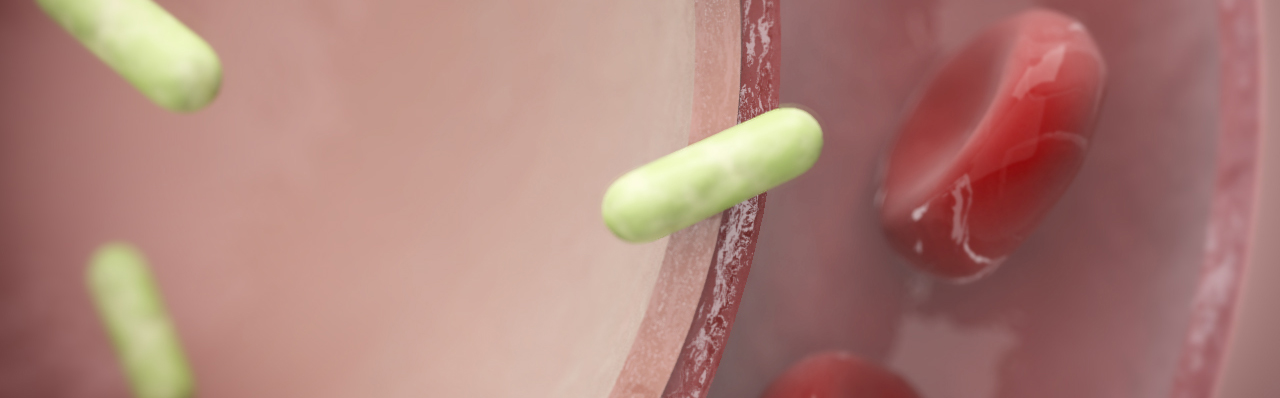 Mycobacterium tuberculosis