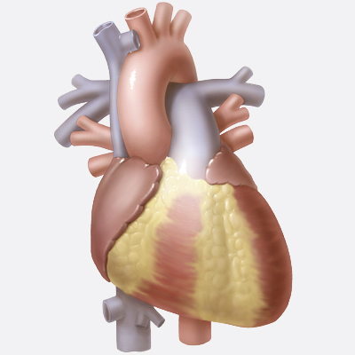 Medical Illustration