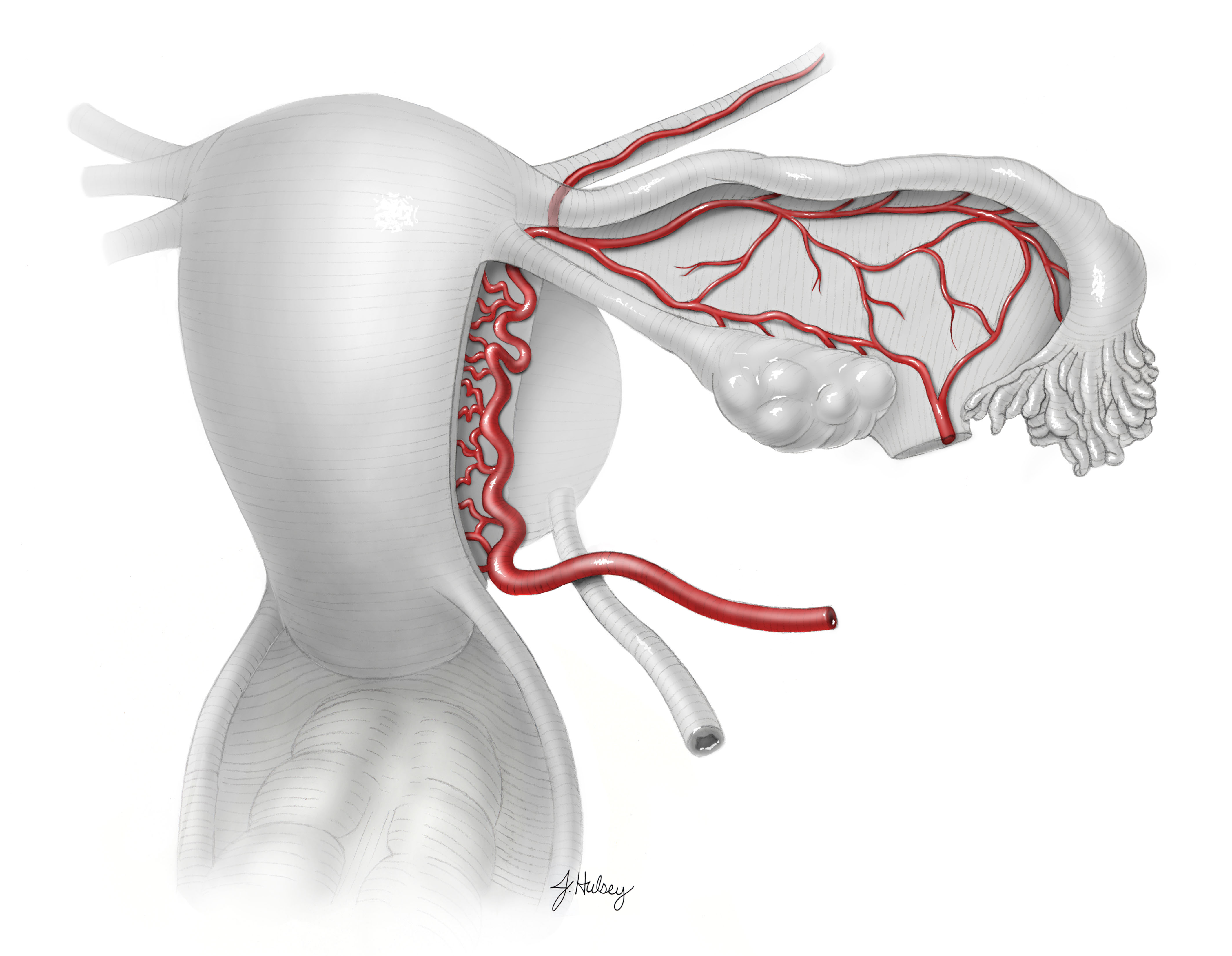 Uterine artery